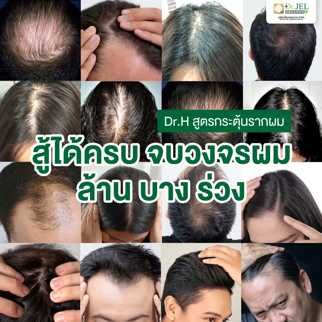 รีวิว Dr.H Hair Tonic