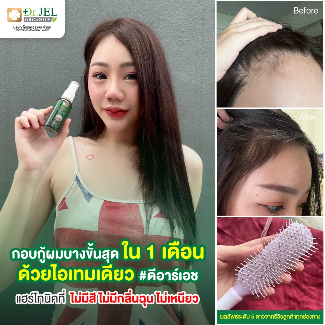 รีวิว เซรั่มปลูกผม dr.h hair tonic